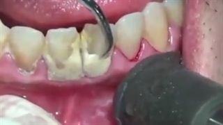 فیلم واقعی جرمگیری