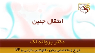 موضوع: انتقال جنین