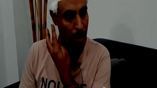 کاشت مو با بالاترین تراکم | کلینیک آفرینش