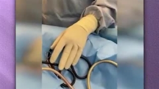 لیپوماتیک شکم و پهلو و تزریق چربی به باسن | دکتر رفیع