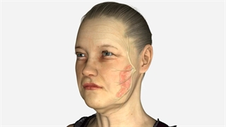 موثرترین روش لیفتینگ صورت