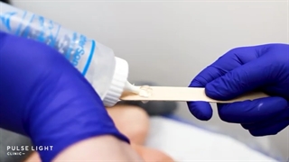 محبوب ترین روش لیفت صورت با هایفو