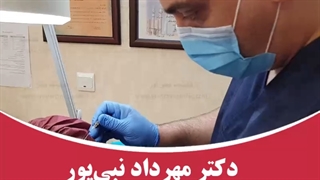 رفع خط بغض با نخ
