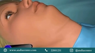 لیپوماتیک غبغب