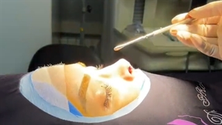 لایو جراحی بینی