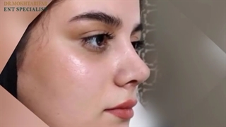جراحی زیبایی در بینی گوشتی