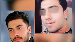 رضایت مراجعه کننده از عمل بعد از یک سال و نیم