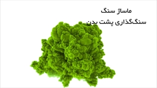 نحوه قرار دادن سنگ ماساژ بر روی بدن