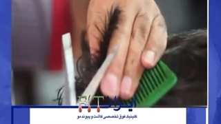 کلینیک تخصصی کاشت مو ایران FIT