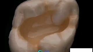 بازسازی زیبایی دندان