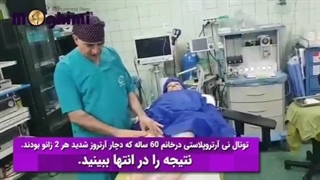 نتیجه عمل تعویض مفصل زانو در بیمار ۶۰ ساله