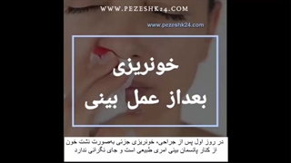 علت خونریزی بعد از عمل بینی چیست و تا کی ادامه دارد؟