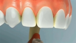 مزایای استفاده از نخ دندان