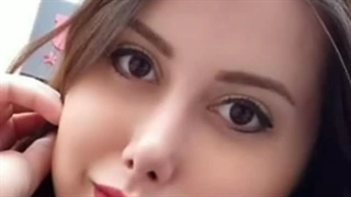 نمونه جراحی زیبایی بینی