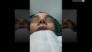 فیلم واقعی عمل بینی در اتاق عمل توسط دکتر طاهری نیا