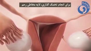 تخمک گذاری