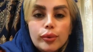 رضایت مراجعه گننده از کاشت ابرو| کلینیک ابروان