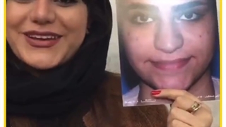 رضایت از عمل بینی