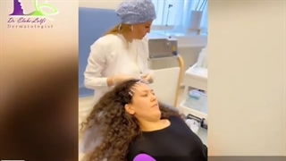 فیلم درمان ریزش مو با جدیدترین متد دنیا؛ استفاده از نخ های محرک رشد مو