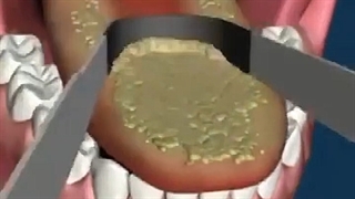 مراقب سلامت زبان خود باشید!!!