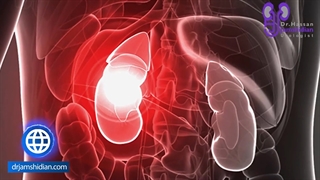 افراد تک کلیه ای: آیا لازم هست بیشتر مواظب باشند؟
