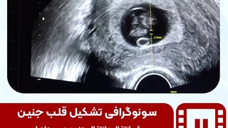 موضوع: موشن سونوگرافی کاور 1-1 نیکان