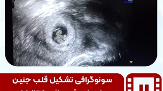 موضوع: موشن سونوگرافی کاور 2-1 نیکان