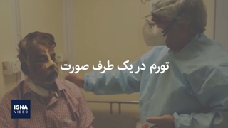 «قارچ سیاه»؛ تهاجمی، خطرناک، قابل پیشگیری