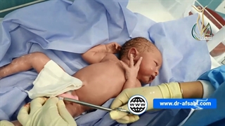 فیلم کامل و بدون سانسور زایمان سزارین