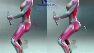 طرز صحیح اسکات زدن بدون آسیب به کمر| دکتر اشکان خواجو