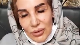 فیلم رضایت از کاشت ابرو| کلینیک ابروان