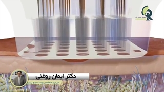 جوانسازی پوست با آر اف