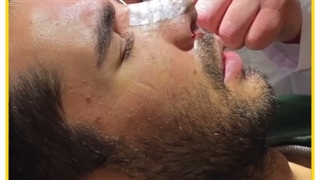 عمل بینی مردانه