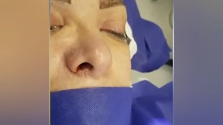 جراحی ترمیمی بینی