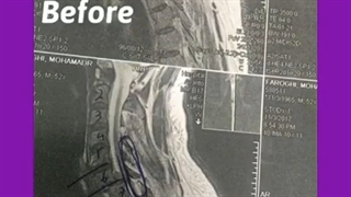 درمان بیماری با بی اختیاری ادرار و مدفوع مراجعه کرده بودند