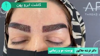 کاشت ابروی طبیعی بر روی تتو