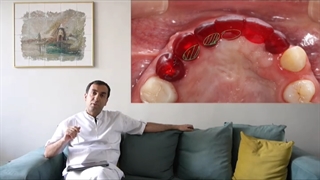 درمان زیبایی و ایمپلنت