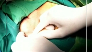 عمل بیضه نزول نکرده و قرار دادن در جای خود