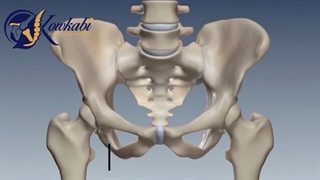 فیلم واقعی جراحی تعویض مفصل لگن