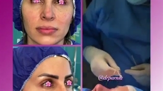 جراحی زیبایی بینی