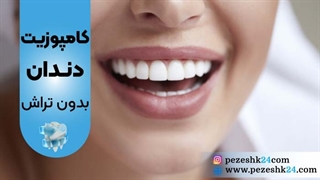 کامپوزیت دندان بدون تراش