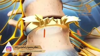 وظیفه دیسک کمر چیست؟