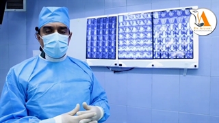 کایفوپلاستی چیست و چگونه انجام می شود؟