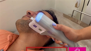 هایفو دابلو گلد