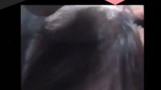 بهترین روش کاشت مو برای زنان چه روشی است؟