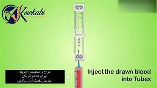 پی آر پی چه نقشی در درمان زانو درد دارد؟