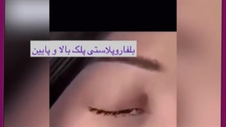 برداشتن پف چشم