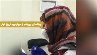 رفع چین و چروک دور چشم با تزریق فیلر و مزوتراپی