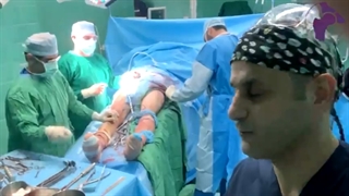 تعویض مفصل دو طرفه همزمان با برش قدامی