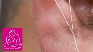 روش منسوخ شده حذف موهای زائد